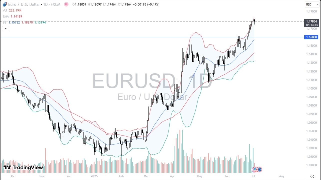 【XM Forex】--EUR/USD Forecast: Traders Brace for NFP Volatility(图1)