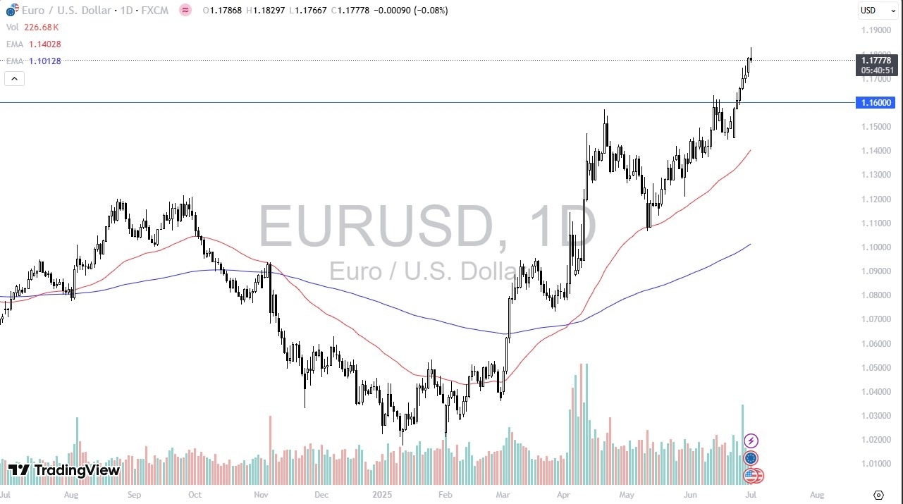 【XM Market Analysis】--EUR/USD Forecast: Retreats After JOLTS Data as Rally Stalls(图1)