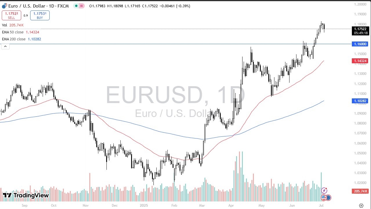 【XM Group】--EUR/USD Forecast: Drops After NFP(图1)