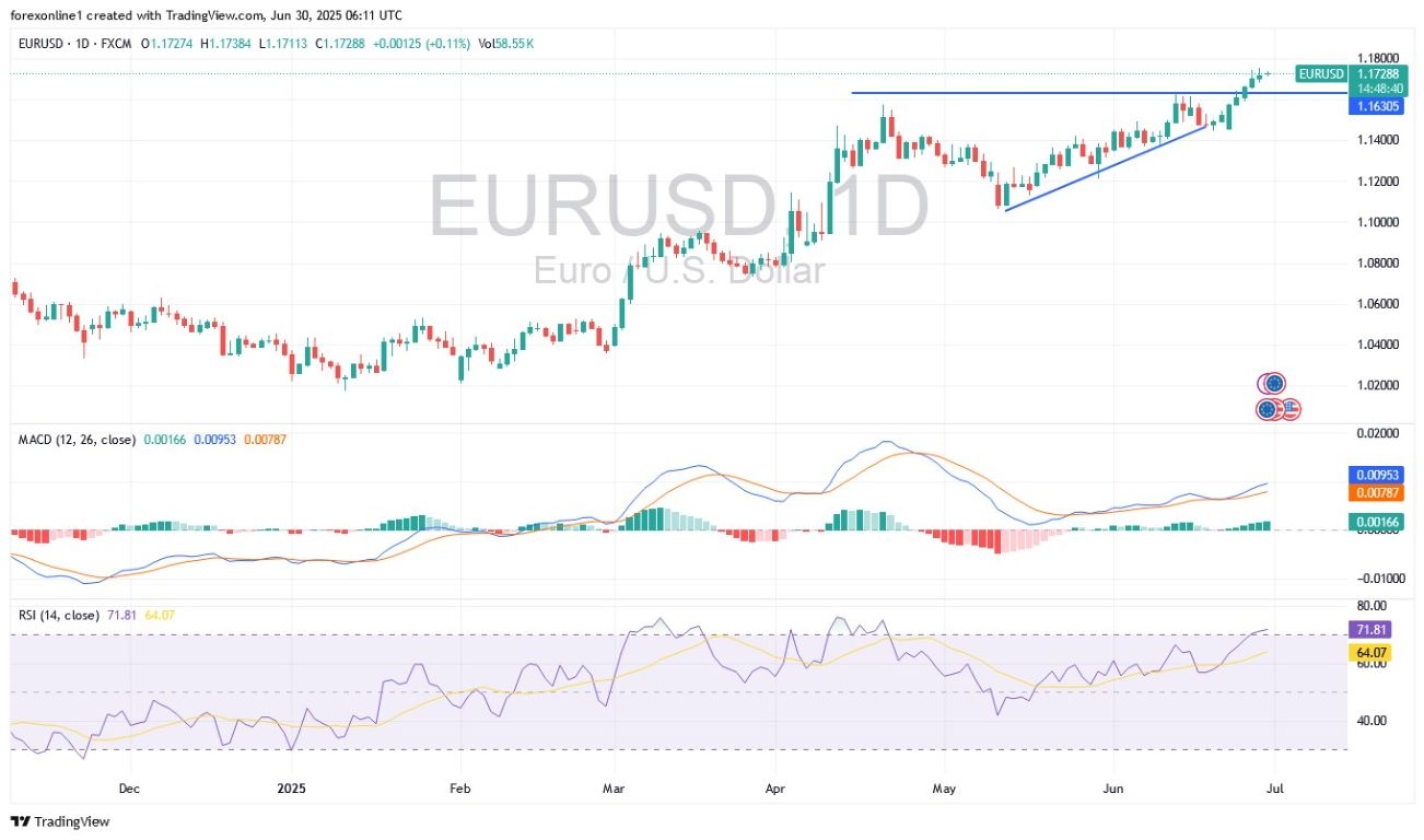【XM Decision Analysis】--EUR/USD Analysis: Euro Trading Upward Until US Jobs Data(图1)