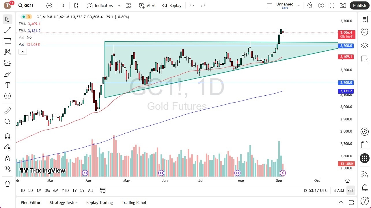 【XM Group】--Gold Forecast: Drops to Find Buyers(图1)